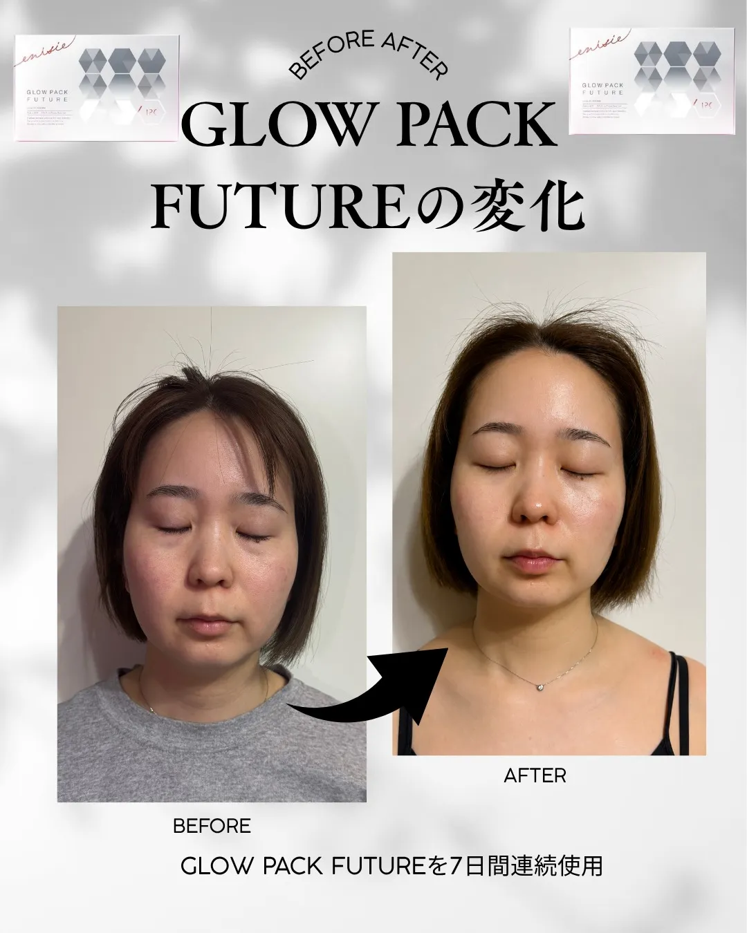 GLOW PACK FUTURE　ビフォーアフター